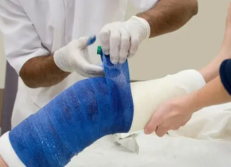 گچ گیری و باز کردن گچ در محل
